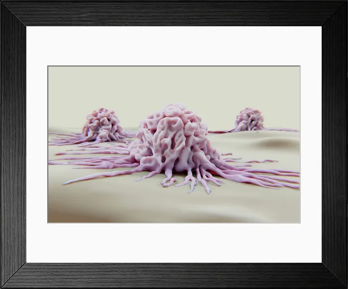 Framed Print : Cancer cells migrating