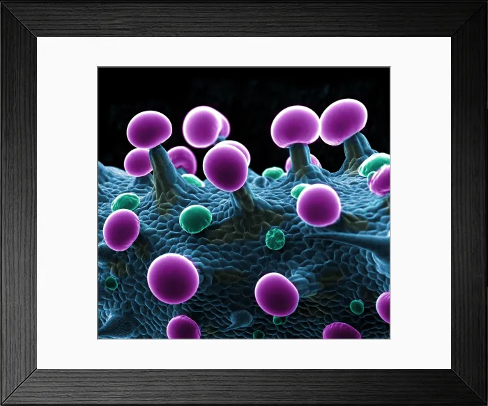 Framed Print : SEM Cannabis Trichomes Framed Print : SEM Cannabis Trichomes