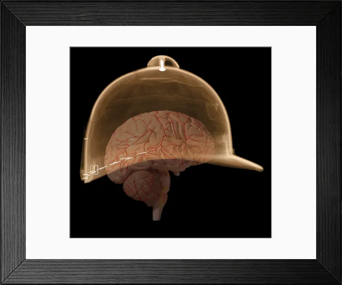 Framed Print : X-ray of Equestrian Helmet Framed Print : X-ray of Equestrian Helmet