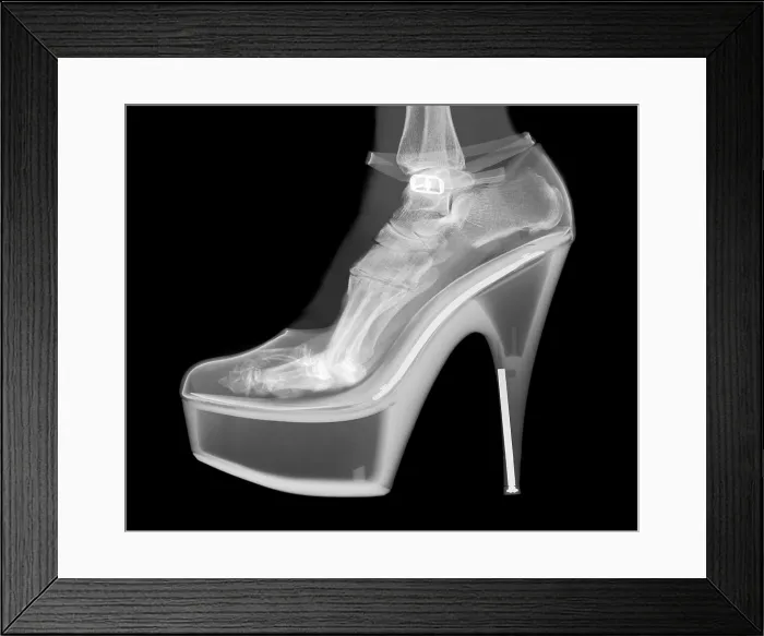 Framed Print : An X-ray of a foot in a High Heel Shoe