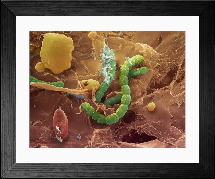 Framed Print : Bacteria, scanning electron micrograph