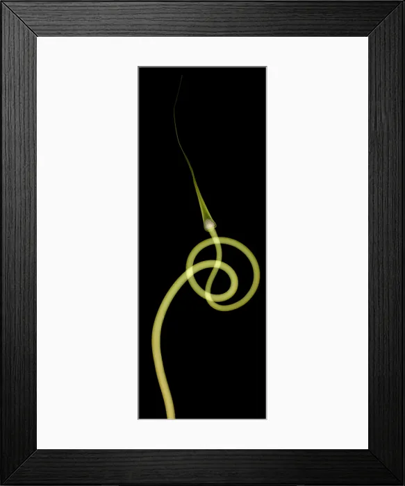 Framed Print : Hardneck Garlic Scapes, X-ray Framed Print : Hardneck Garlic Scapes, X-ray