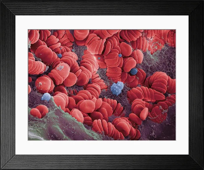 Framed Print : Human Red Blood Cells, under a microscope (SEM) Framed Print : Human Red Blood Cells, under a microscope (SEM)