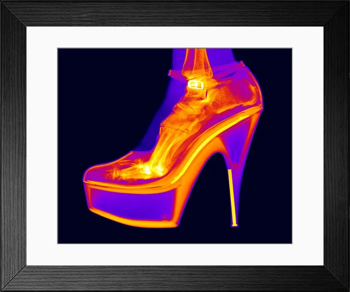 Framed Print : An X-ray of a foot in a High Heel Shoe Framed Print : An X-ray of a foot in a High Heel Shoe