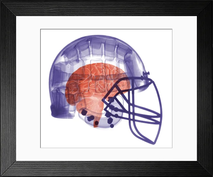 Framed Print : X-ray of Head in Football Helmet Framed Print : X-ray of Head in Football Helmet