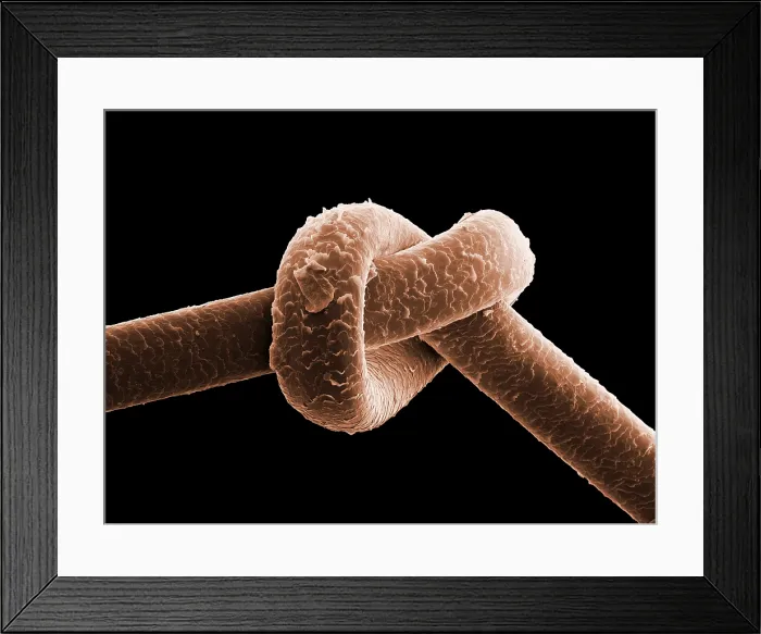 Framed Print : Knot in Human Hair, under a microscope (SEM) Framed Print : Knot in Human Hair, under a microscope (SEM)