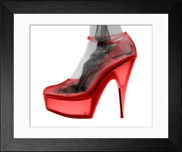Framed Print : An X-ray of a High Heel Shoe Framed Print : An X-ray of a High Heel Shoe