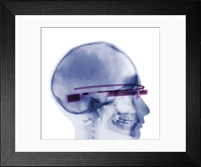 Framed Print : Woman Wearing Google Glass, X-ray Framed Print : Woman Wearing Google Glass, X-ray
