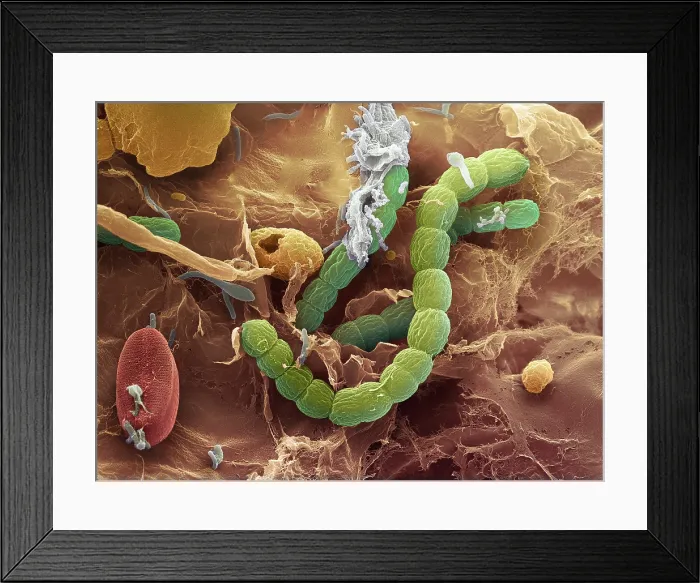 Framed Print : Bacteria, scanning electron micrograph