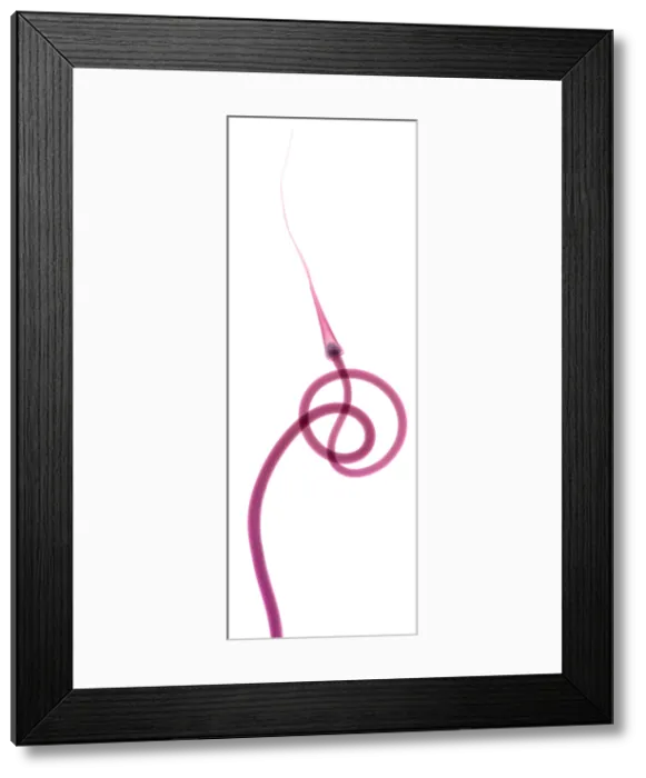 Framed Print : Hardneck Garlic Scapes, X-ray Framed Print : Hardneck Garlic Scapes, X-ray