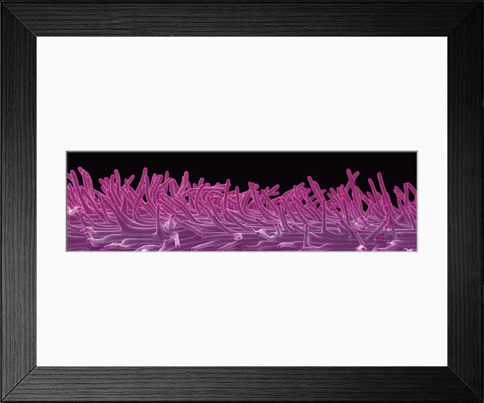 Framed Print : Cannabis Stigma, scanning electron micrograph Framed Print : Cannabis Stigma, scanning electron micrograph