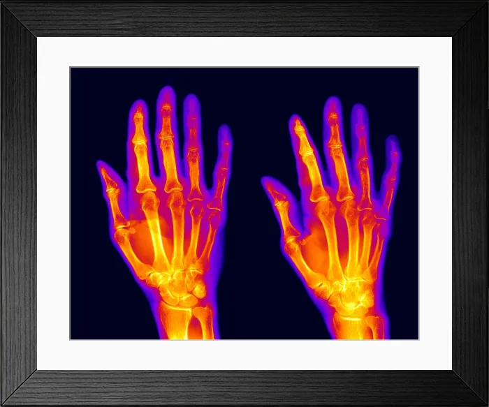 Framed Print : Normal Hand Framed Print : Normal Hand