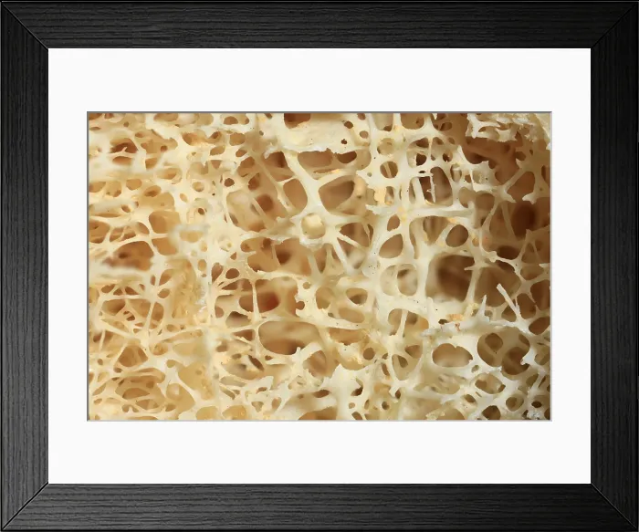 Framed Print : Dried Human Bone, Normal