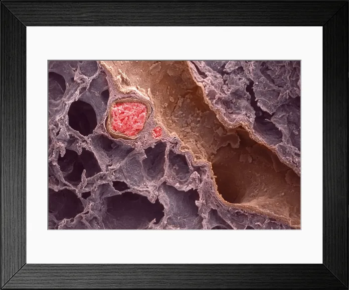 Framed Print : Human Lung, under a microscope (SEM) Framed Print : Human Lung, under a microscope (SEM)