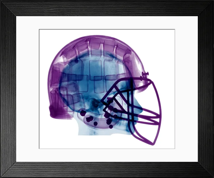 Framed Print : Football Helmet, X-Ray Framed Print : Football Helmet, X-Ray