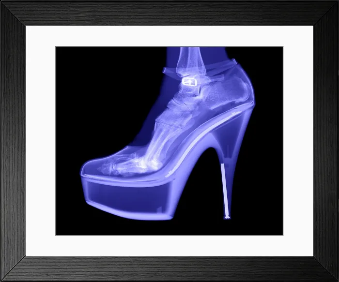 Framed Print : An X-ray of a foot in a High Heel Shoe Framed Print : An X-ray of a foot in a High Heel Shoe