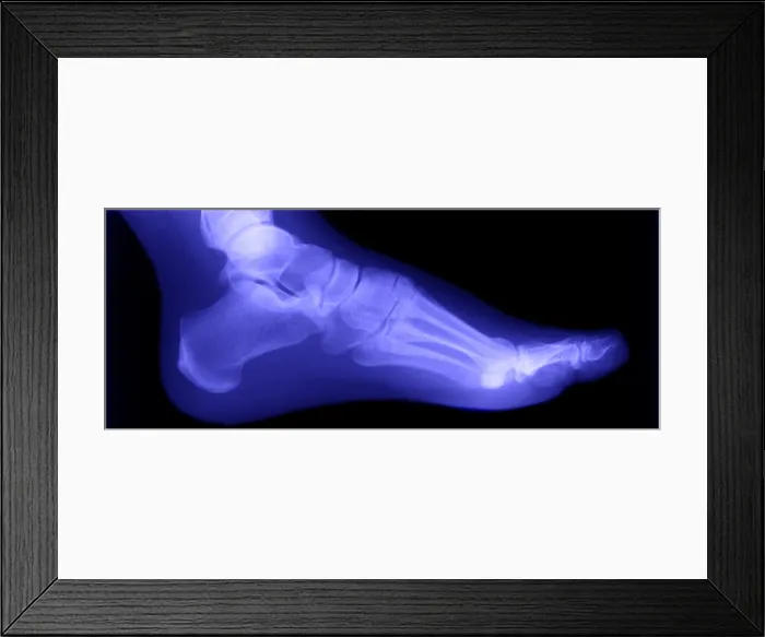 Framed Print : Normal Human Foot Framed Print : Normal Human Foot