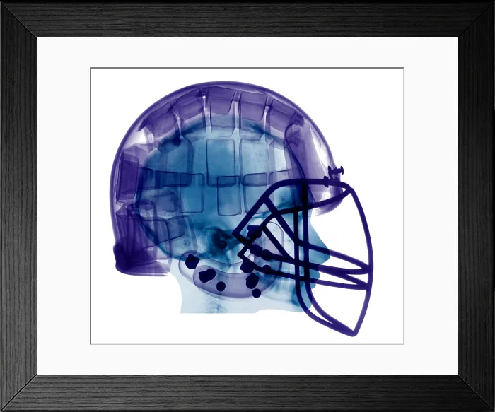 Framed Print : Football Helmet, X-Ray Framed Print : Football Helmet, X-Ray