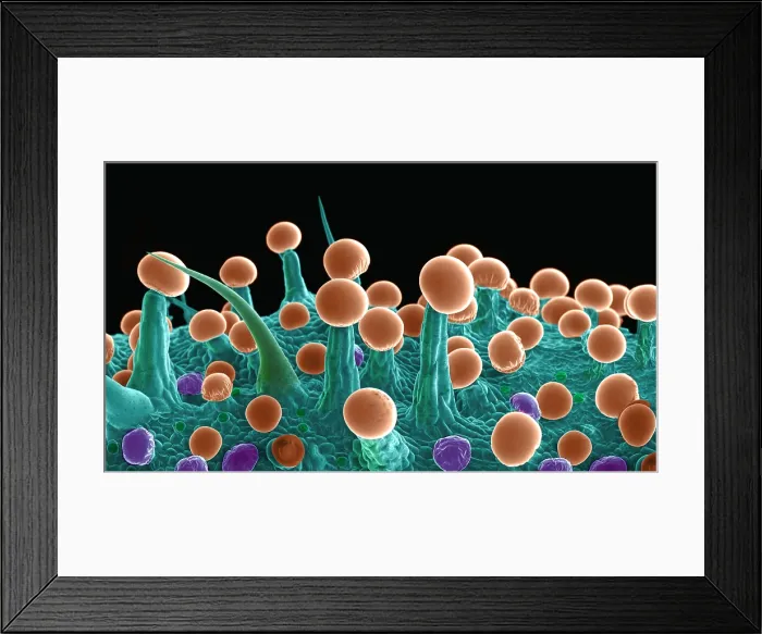 Framed Print : Cannabis Trichomes, scanning electron micrograph Framed Print : Cannabis Trichomes, scanning electron micrograph