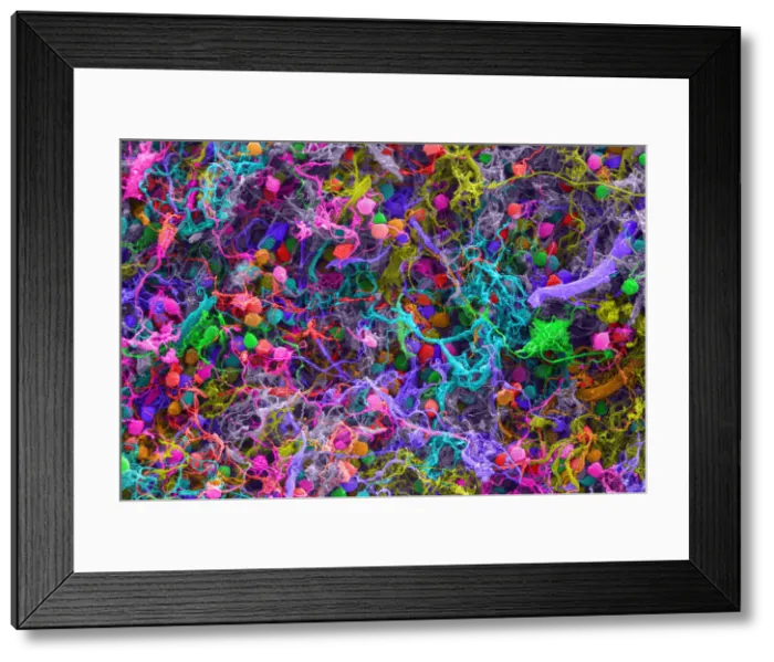 Framed Print : Human Brain Cells, under a microscope (SEM) Framed Print : Human Brain Cells, under a microscope (SEM)