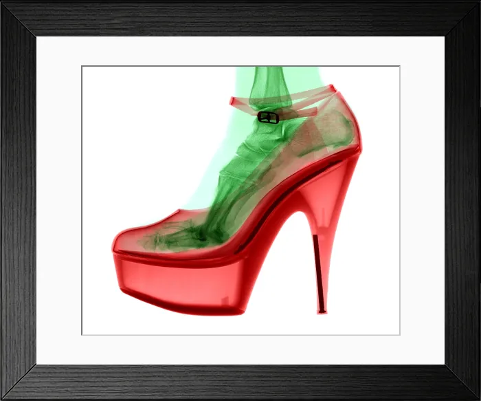 Framed Print : An X-ray of a foot in a High Heel Shoe