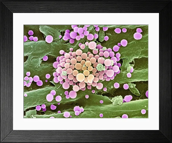 Framed Print : Bacteria on Hops Leaf, under a microscope (SEM) Framed Print : Bacteria on Hops Leaf, under a microscope (SEM)