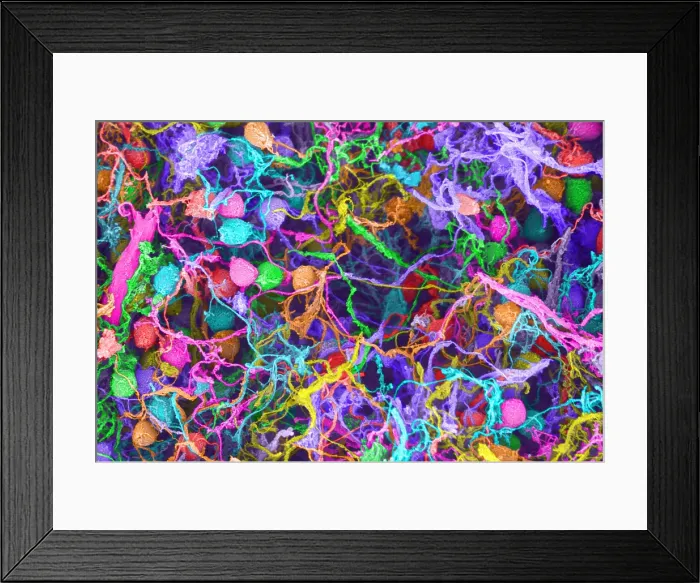 Framed Print : Human Brain Cells, under a microscope (SEM) Framed Print : Human Brain Cells, under a microscope (SEM)