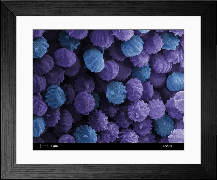 Framed Print : SEM of Ergot