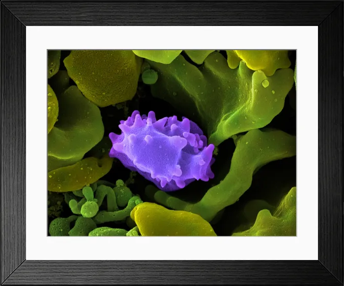 Framed Print : Human Lymphocyte Cell, under a microscope (SEM) Framed Print : Human Lymphocyte Cell, under a microscope (SEM)