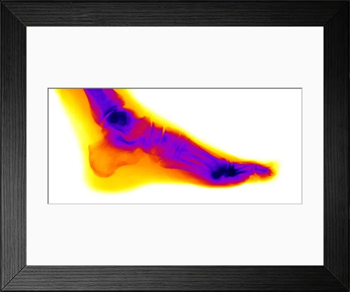 Framed Print : Normal Human Foot Framed Print : Normal Human Foot