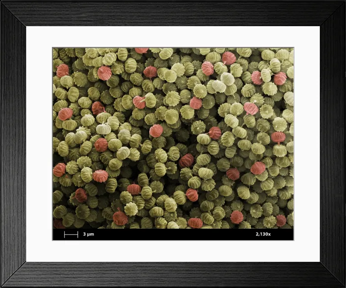 Framed Print : SEM of Ergot