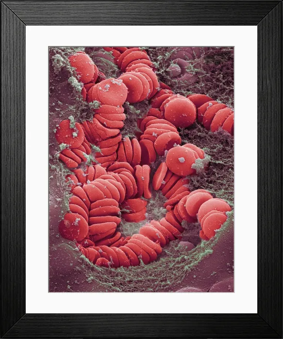 Framed Print : Human Red Blood Cells, under a microscope (SEM)