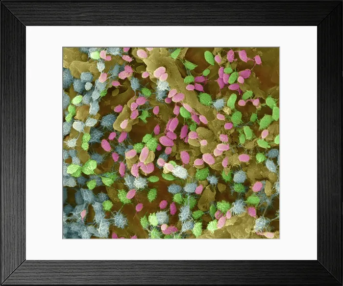 Framed Print : SEM, Protozoa on Cannabis Seed Framed Print : SEM, Protozoa on Cannabis Seed