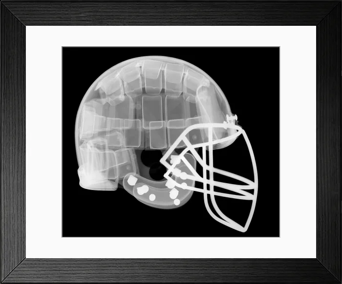 Framed Print : Football Helmet, X-Ray Framed Print : Football Helmet, X-Ray