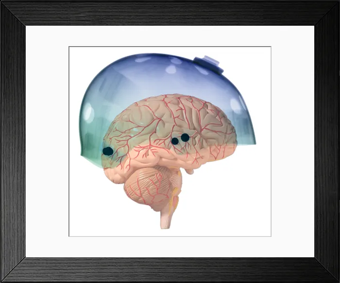 Framed Print : Brain in Skateboard Helmet Framed Print : Brain in Skateboard Helmet