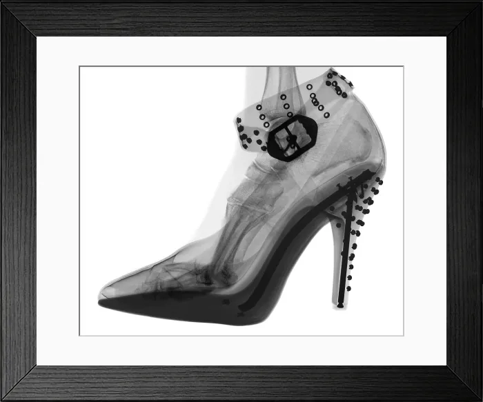 Framed Print : An X-ray of a foot in a High Heel Shoe Framed Print : An X-ray of a foot in a High Heel Shoe
