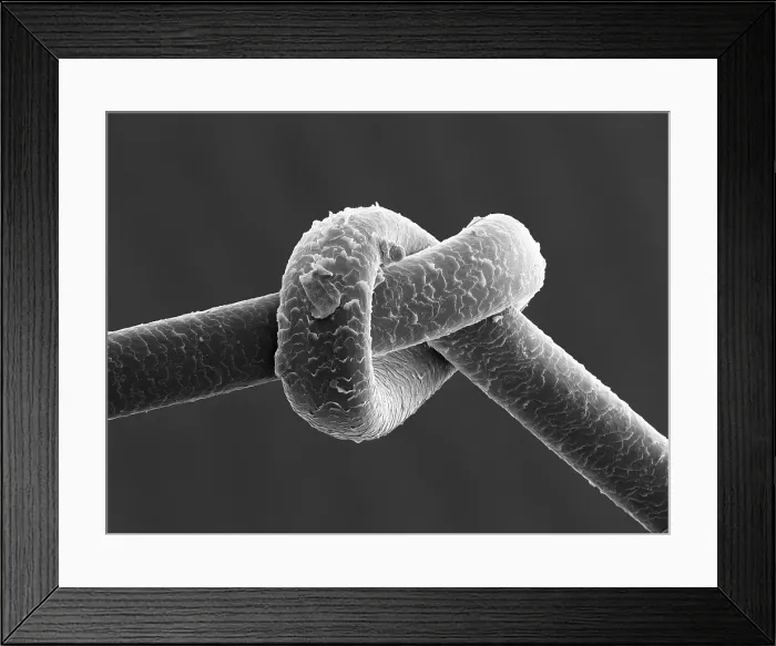 Framed Print : Knot in Human Hair, under a microscope (SEM) Framed Print : Knot in Human Hair, under a microscope (SEM)