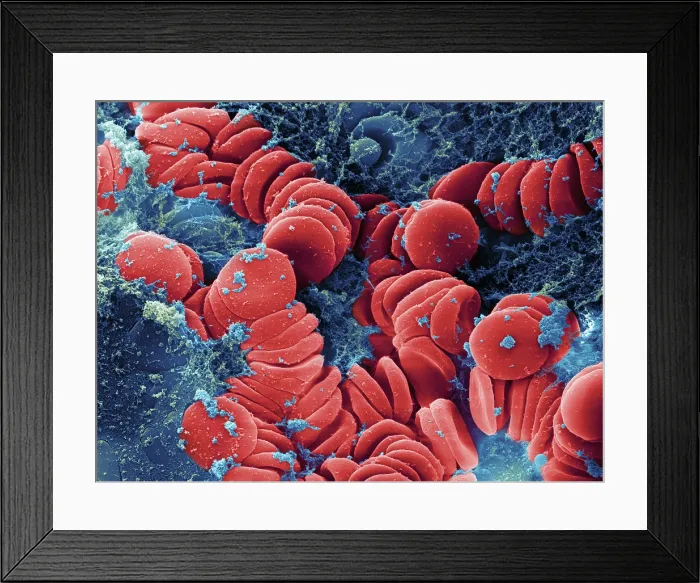 Framed Print : Human Red Blood Cells, under a microscope (SEM)