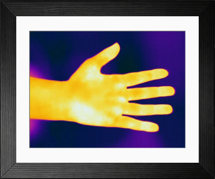 Framed Print : Thermogram of a Hand