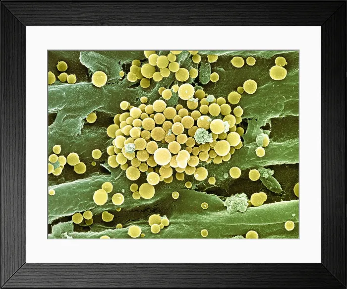 Framed Print : Bacteria on Hops Leaf, scanning electron micrograph Framed Print : Bacteria on Hops Leaf, scanning electron micrograph