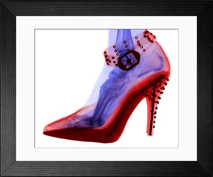 Framed Print : An X-ray of a foot in a High Heel Shoe