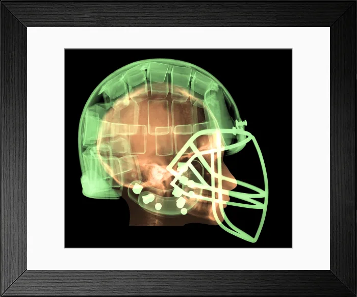 Framed Print : Football Helmet, X-Ray Framed Print : Football Helmet, X-Ray