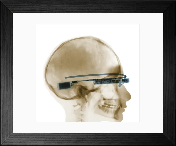 Framed Print : Woman Wearing Google Glass, X-ray Framed Print : Woman Wearing Google Glass, X-ray