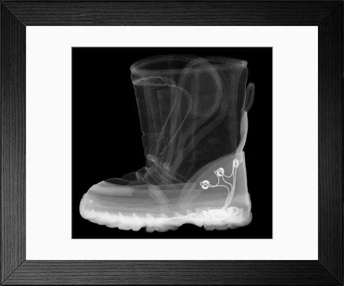Framed Print : X-ray of a Child's Light-Up Boot