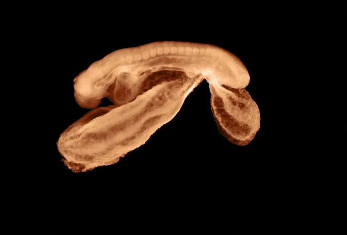 Framed Print : 23 day old human embryo