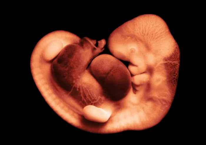 Framed Print : 35 day old human embryo Framed Print : 35 day old human embryo