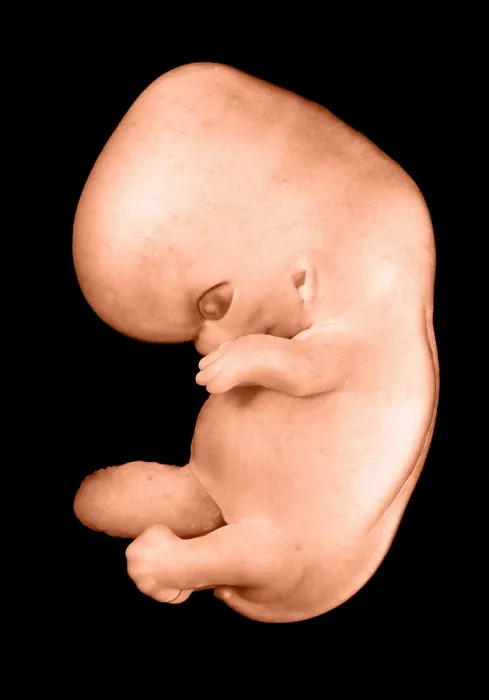 Framed Print : 44 day old human embryo Framed Print : 44 day old human embryo