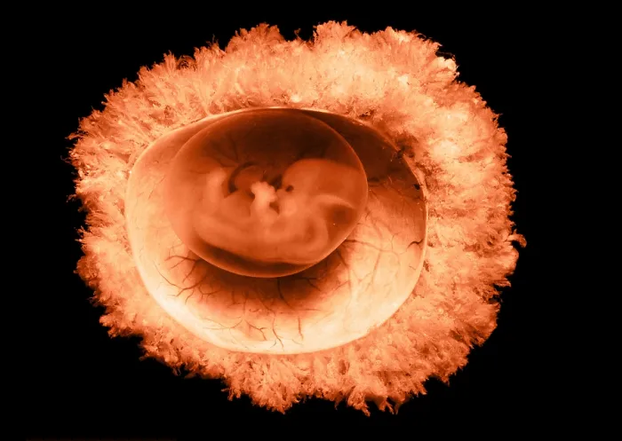 Framed Print : 45 day old human embryo Framed Print : 45 day old human embryo