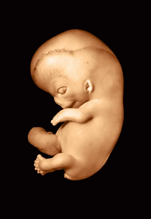 Framed Print : 51 day old human fetus Framed Print : 51 day old human fetus