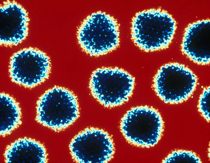 Framed Print : Adenovirus, TEM Framed Print : Adenovirus, TEM